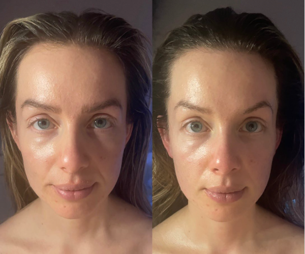 Japanse Kobido (Facelift) massage